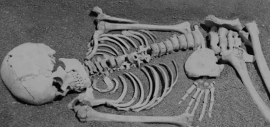 कञ्चनपुरमा रुखमा झुण्डिएको अवस्थामा मानव कंकाल फेला