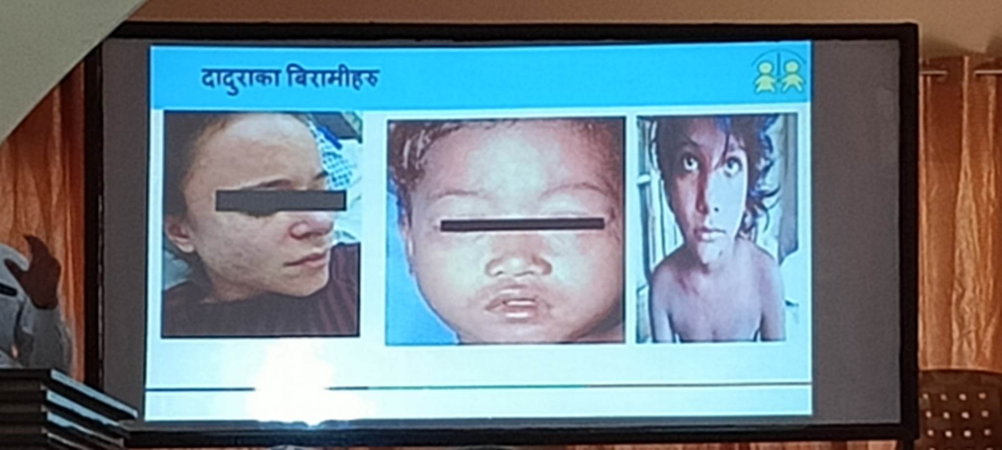 कञ्चनपुरमा दादुरा रुवेलाको खोप अभियान संचालन हुने