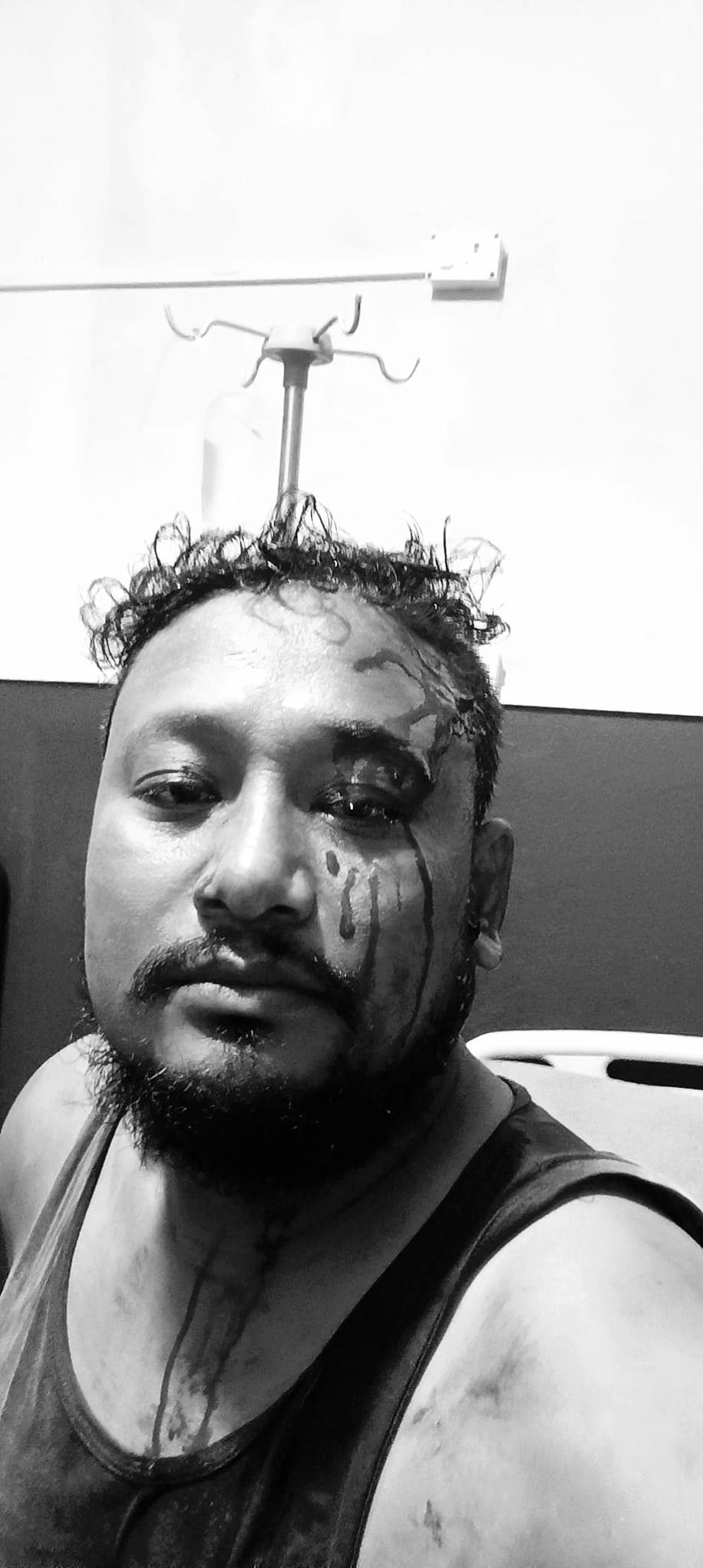 बेलौरीमा एक जना होटेल सञ्चालकमाथि कुटपिट