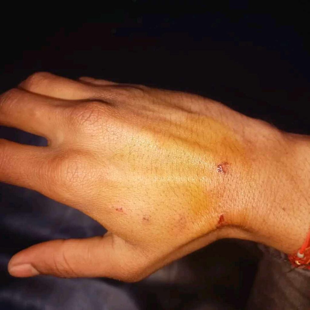 बेलाैरी खप्टी नाला नजिक बाघले मोटरसाइकल माथी आक्रमण